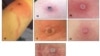 Recent Death Brings Attention to Alaskapox Virus