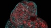 Scientists Grow Mini-Organs in Cells from Pregnancy Fluid