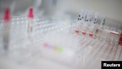 Vials of different blood types are pictured in a hospital.