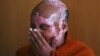 FILE - Image shows a woman, an acid attack survivor, Jan. 22, 2010.