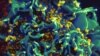 A scanning electron micrograph shows HIV particles infecting a colorized human H9 T cell (Credit: NIAID) FILE PHOTO