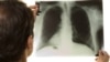 Doctor studying chest X-Ray