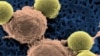 This microscopy image provided by Dr. Carl June shows immune system T-cells (C) binding to beads that cause the cells to divide, then are later removed to leave pure T-cells, which are then ready for infusion to leukemia patients, August 2011.