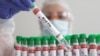 Scientists Test mRNA Vaccines to Protect Against Bird Flu
