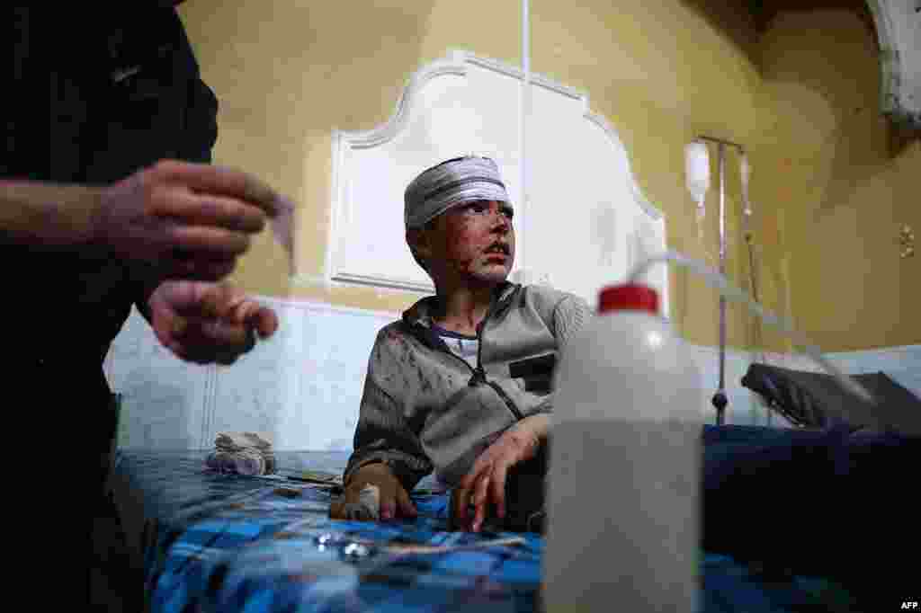 Seorang anak laki-laki Suriah mendapatkan perawatan di rumah sakit darurat setelah pasukan Suriah menggempur kota Douma, sebelah timur Damaskus.