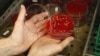 An employee displays MRSA bacteria strain - a drug-resistant 'superbug' - inside a petri dish containing agar jelly for bacterial culture in a microbiological laboratory in Berlin, March 1, 2008.