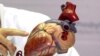 FILE - model of a human heart.