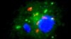Mycobacterium tuberculosis (red) is hiding in human white blood cells (blue and green) cultured in vitamin D-deficient serum 