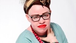 Ezabesifazana: Sixoxa Lophila Lesimo seAlbinism uMarvelous Tshuma 