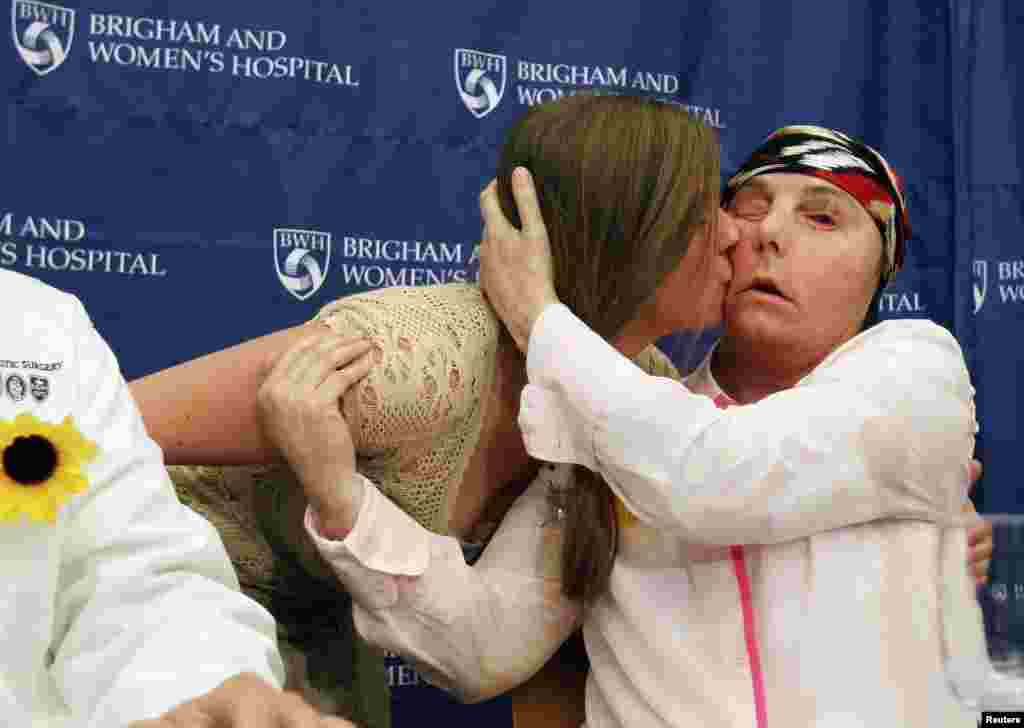 Marinda Righter (kiri), anak perempuan dari pemberi donor 'wajah' Cheryl Denelli-Righter, mencium penerima 'transplantasi wajah', Carmen Blandin Tarleton di rumah sakit Brigham and Women's Hospital di kota Boston, Massachusetts, AS.