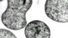 Pyrococcus furiosus (Henry Aldrich, ifas.ufl.edu)