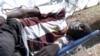 A patient receiving treatment at a temporary structure in Harare, Zimbabwe, Sept. 11, 2018, meant for waterborne diseases such as salmonella, typhoid and cholera which have hit Zimbabwe’s capital city. 