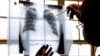 FILE - A doctor examines chest X-rays at a tuberculosis clinic in Gugulethu, Cape Town, South Africa.