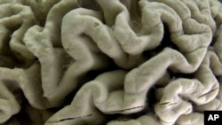 FILE - A closeup of a human brain affected by Alzheimer's disease, is displayed at the Museum of Neuroanatomy at the University at Buffalo in Buffalo, New York, in 2003. (AP Photo/David Duprey)