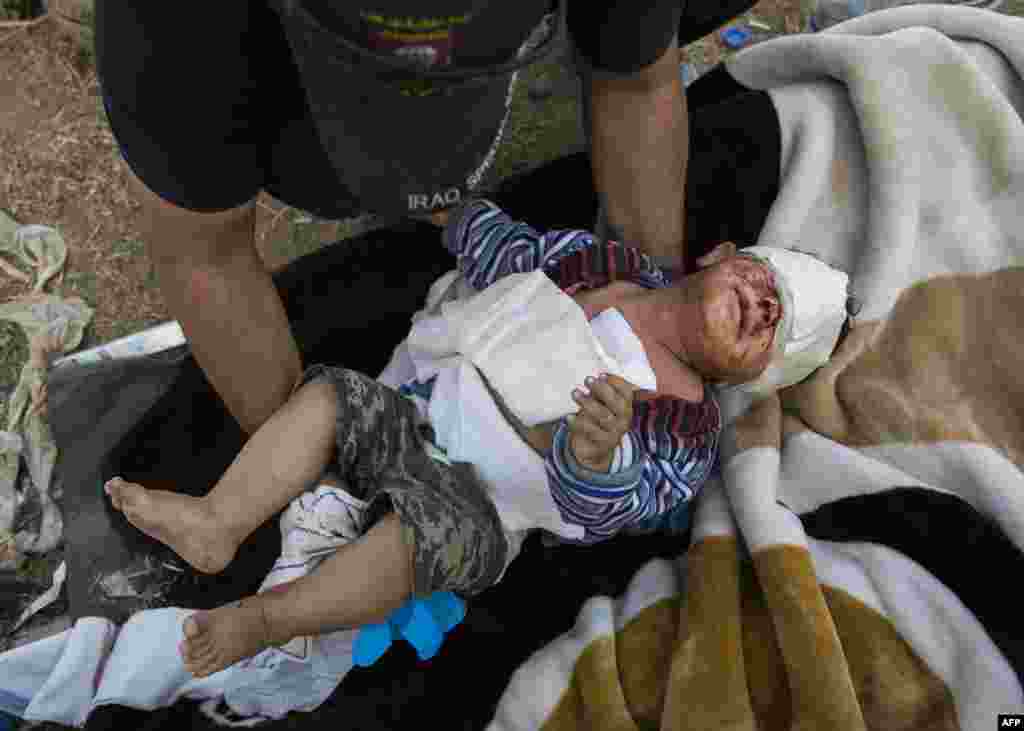 Bayi Jassem (18 bulan) ditolong oleh tim medis militer Irak setelah mengalami luka di kepala dalam pertempuran pasukan Irak melawan militan ISIS di distrik Samah, Mosul, Irak.